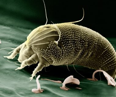 découvrez les technologies avancées de détection des maladies, qui révolutionnent le diagnostic et améliorent la santé publique. apprenez comment ces outils innovants aident à identifier précocement les infections et à prévenir leur propagation.
