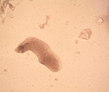 Tardigrades